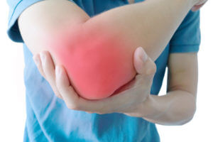 Cubital Tunnel Syndrome