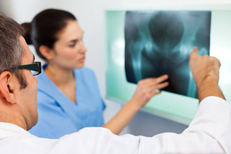 Hip Fracture X-ray