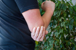 tennis elbow