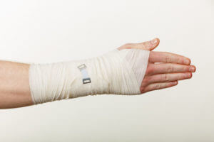 Preventing Hand Dislocations