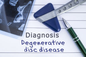 Degenerative Disc Disease
