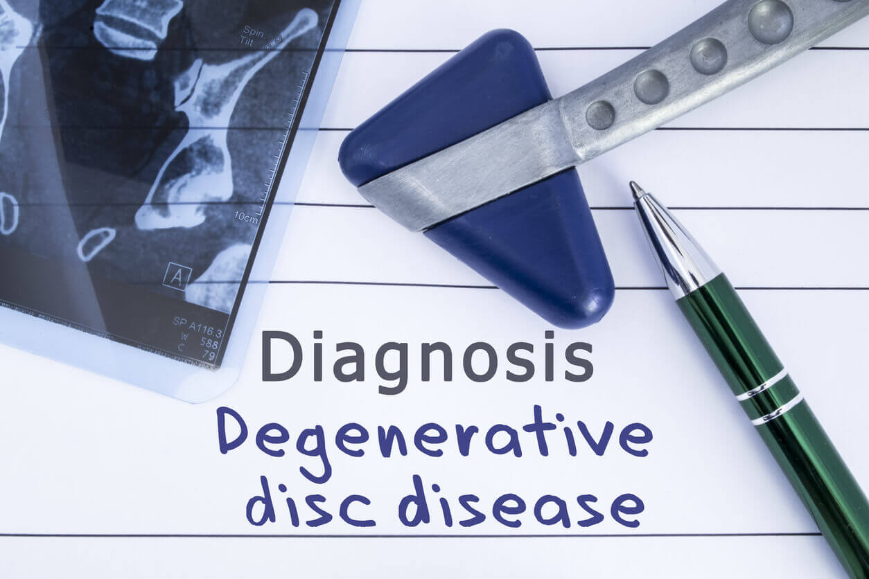 https://www.wataugaortho.com/wp-content/uploads/sites/115/2021/08/Tips-for-Preventing-Degenerative-Disc-Disease.jpg