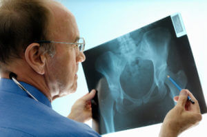 Orthopedic Doctors Treat