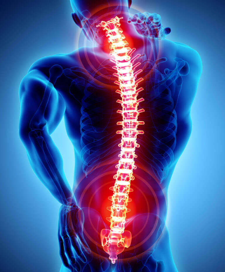 minimally invasive spinal surgery