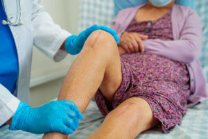 Asian elderly woman patient with scar from knee replacement surgery in hospital.